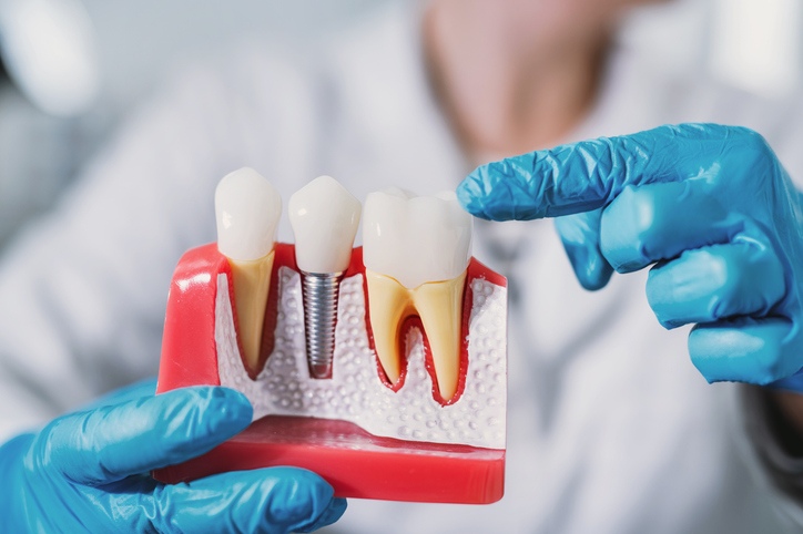 A dentist explaining proper aftercare for long-lasting implants in Wheaton, IL